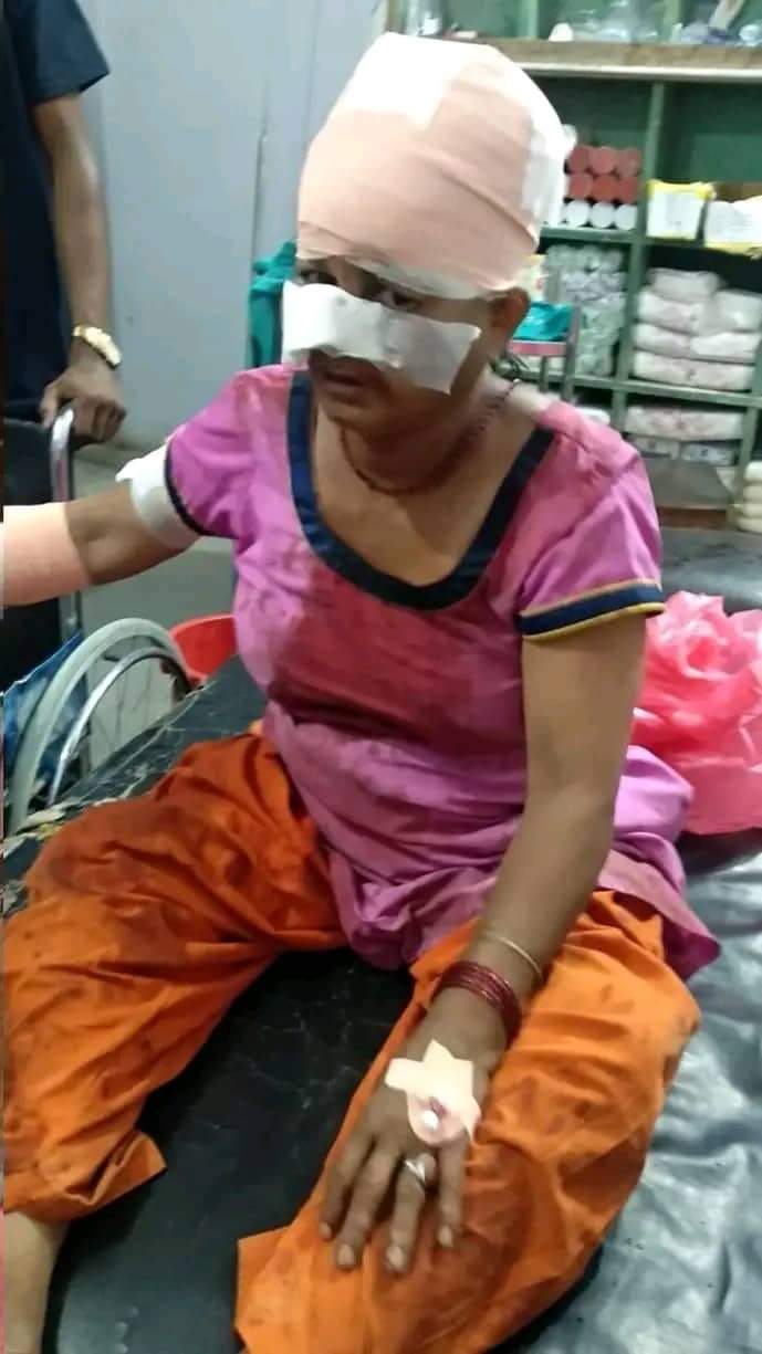 घोडाघोडी ८,मा बाघको आक्रमणबाट एक महिला घाइते
