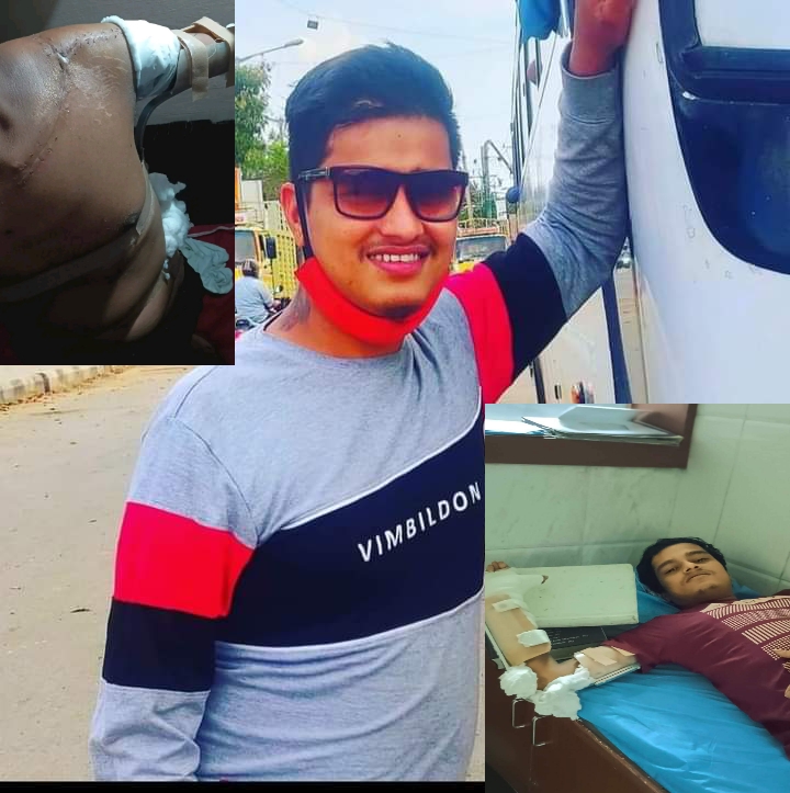 सडक दुर्घटना पीडित धमलाको उपचारमा सहयोगको अपिल